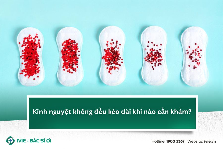 Kinh nguyệt không đều kéo dài khi nào cần khám?