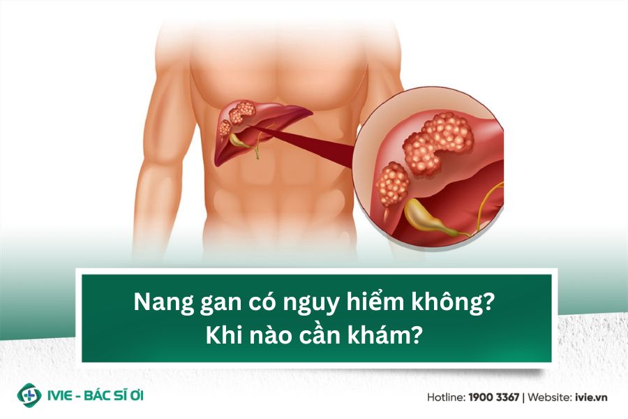 Nang gan có nguy hiểm không? Khi nào cần khám?
