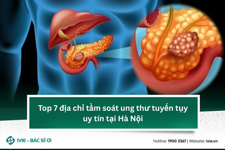 Top 7 địa chỉ tầm soát ung thư tuyến tụy uy tín tại Hà Nội