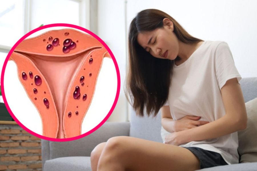 Đau bụng kinh kéo dài và tăng dần theo thời gian là dấu hiệu cảnh báo lạc nội mạc tử cung chị em cần đi khám sớm