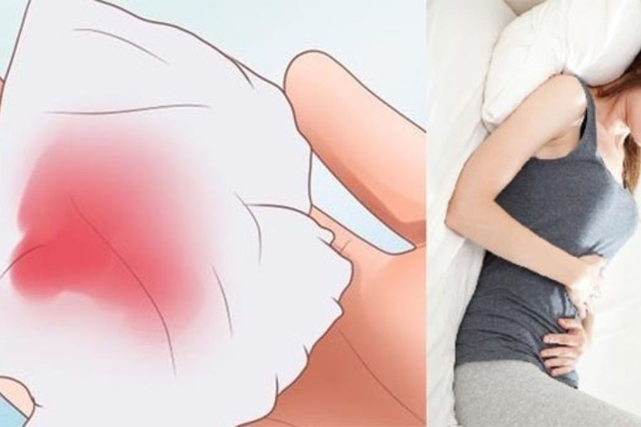 Ra máu khi mang thai 3 tháng đầu có thể là dấu hiệu sinh lý bình thường hoặc cảnh báo bất thường cần được quan tâm đúng mức