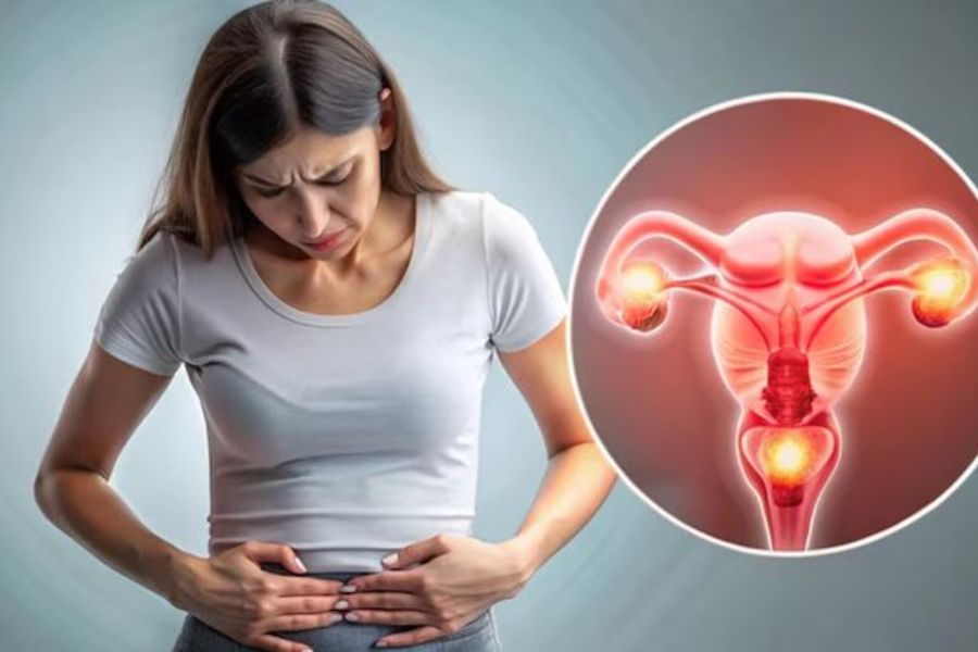 Cơn đau bụng dữ dội đột ngột ở vùng hốc chậu là dấu hiệu cảnh báo hàng đầu của biến chứng xoắn buồng trứng