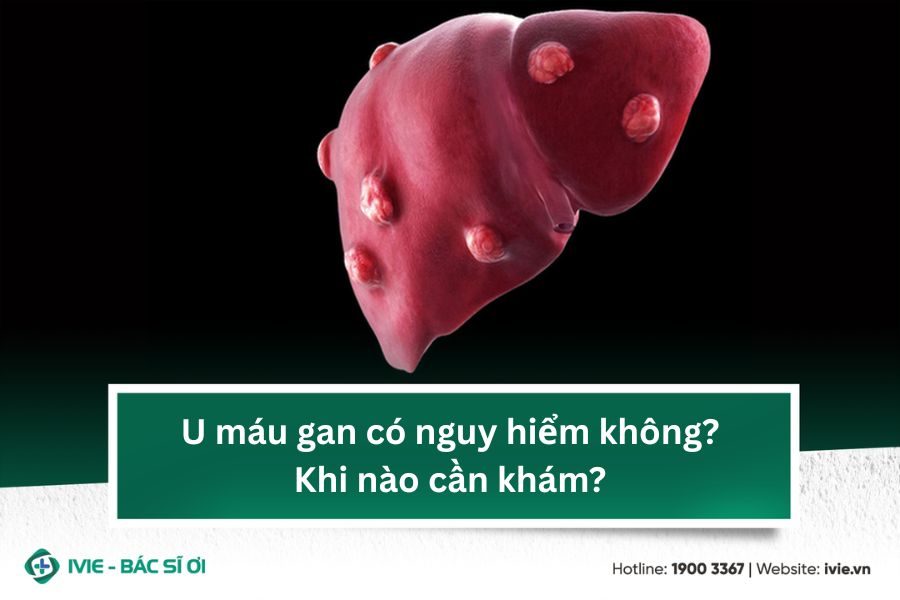 U máu gan có nguy hiểm không? Khi nào cần khám?