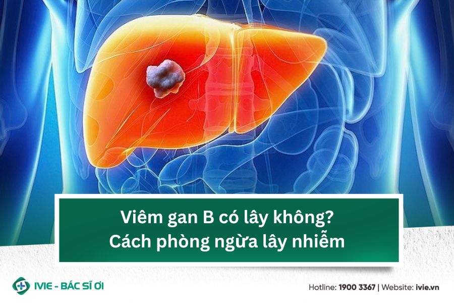 Viêm gan B có lây không? Cách phòng ngừa lây nhiễm
