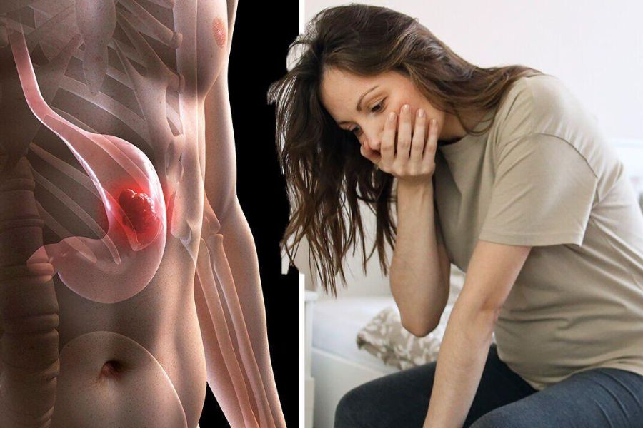Người có tổn thương tiền ung thư hoặc người thân mắc ung thư dạ dày nên được bác sĩ tư vấn tầm soát sớm