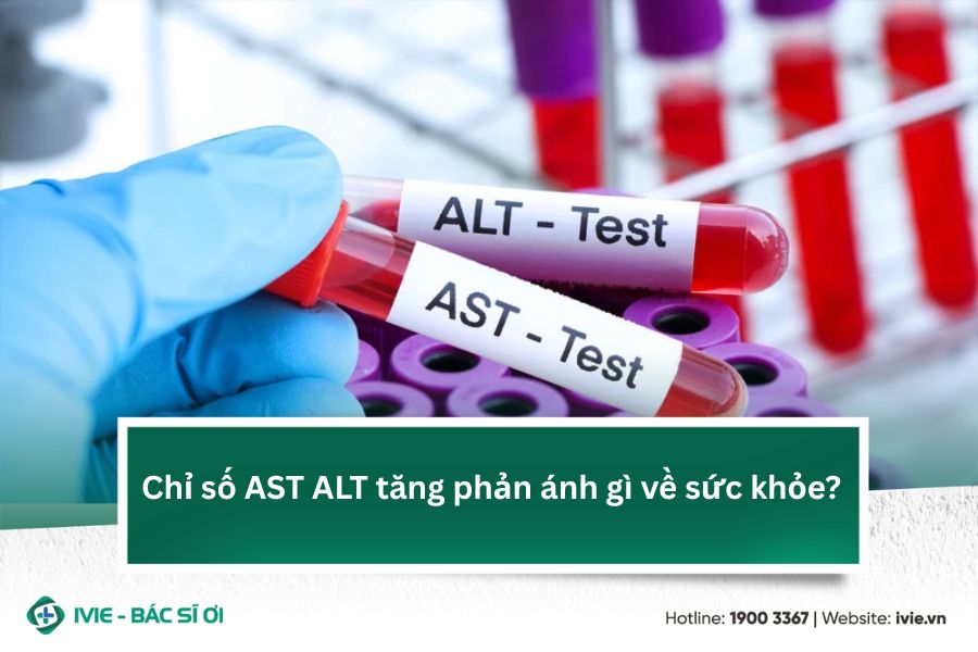 Chỉ số AST ALT tăng phản ánh gì về sức khỏe?