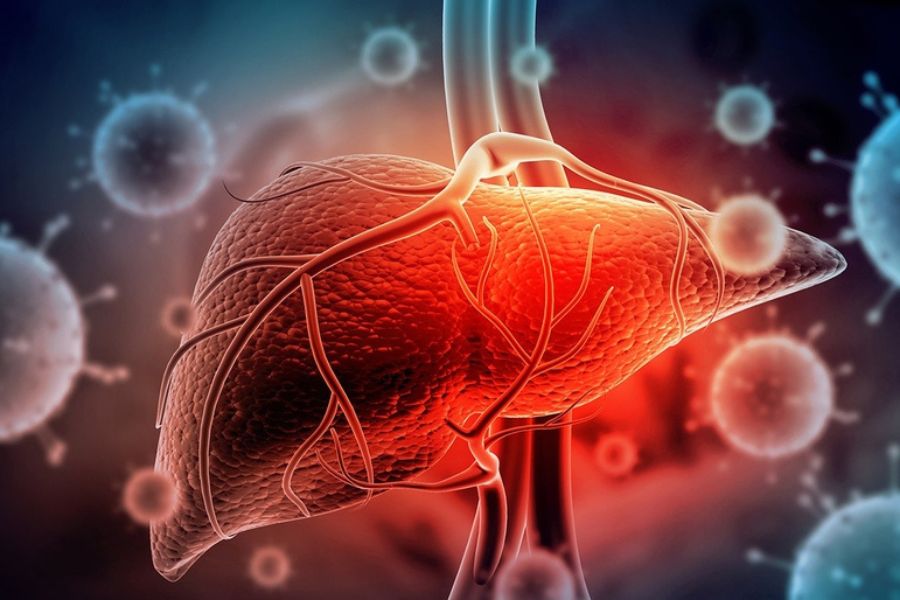 Viêm gan B mạn tính xảy ra khi virus HBV tồn tại lâu dài trong cơ thể, với xét nghiệm HBsAg dương tính kéo dài từ 6 tháng trở lên