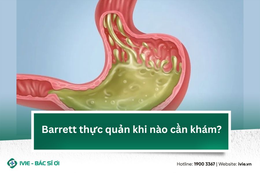 Barrett thực quản khi nào cần khám?
