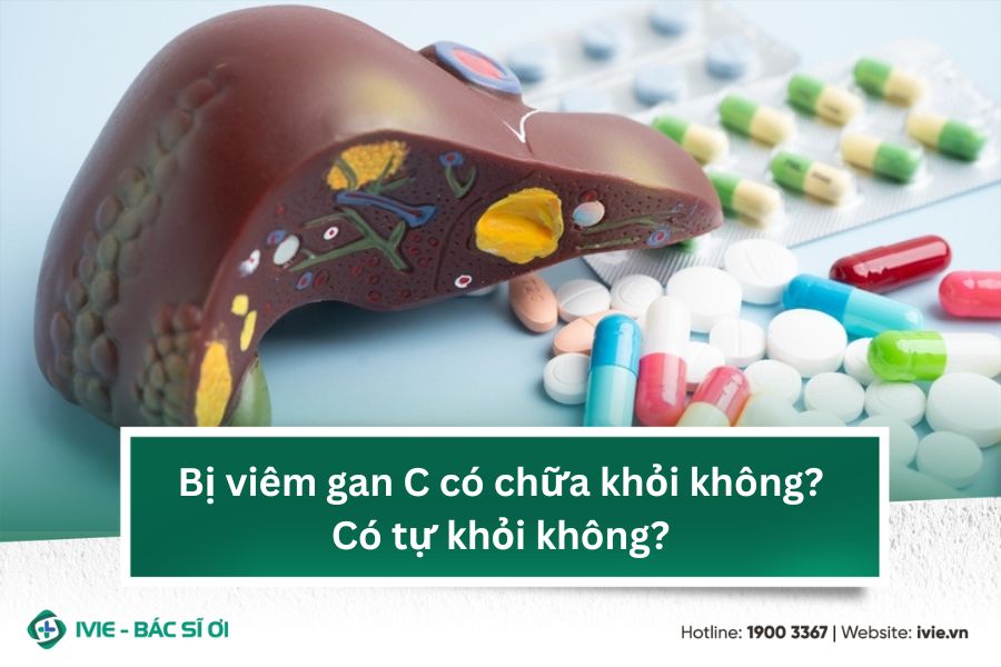 Bị viêm gan C có chữa khỏi không? Có tự khỏi không?