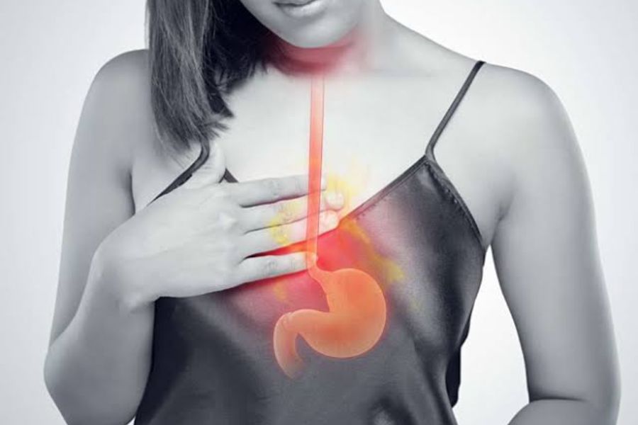 Cơ chế gây bệnh trào ngược dạ dày thực quản do suy yếu cơ vòng dưới thực quản