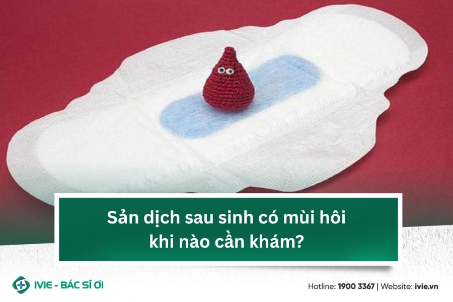Sản dịch sau sinh có mùi hôi khi nào cần khám?