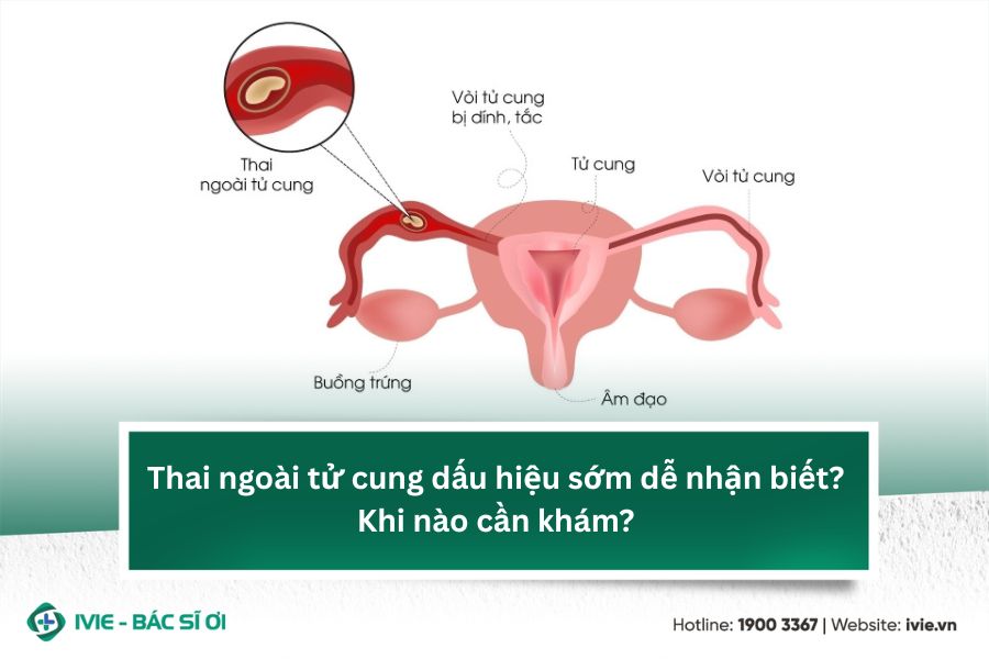 Thai ngoài tử cung dấu hiệu sớm dễ nhận biết? Khi nào cần...