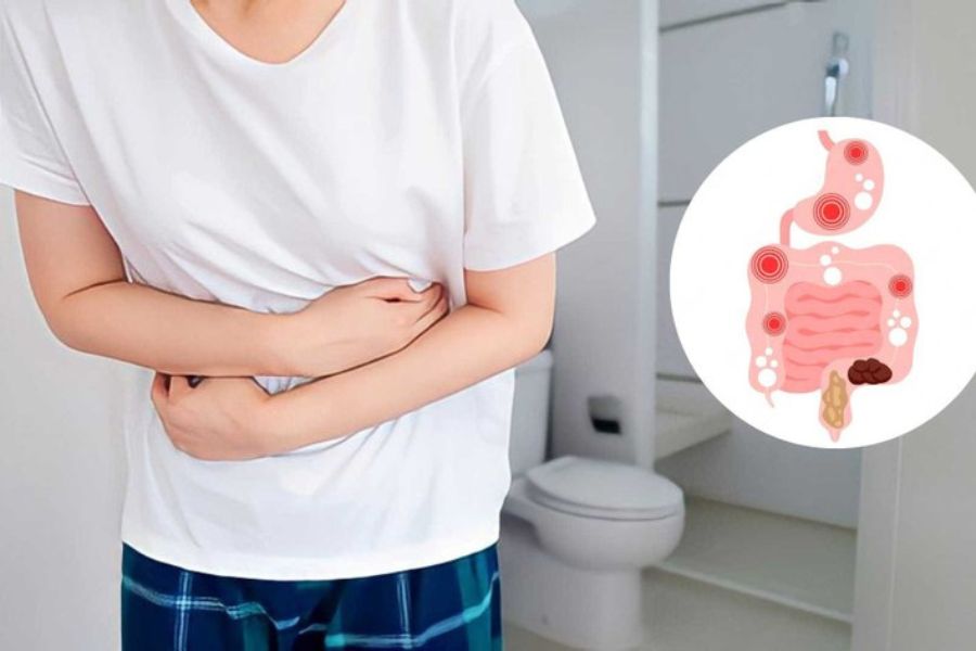 IBS thường gây đau bụng, đầy hơi, kèm tiêu chảy, táo bón hoặc xen kẽ cả hai