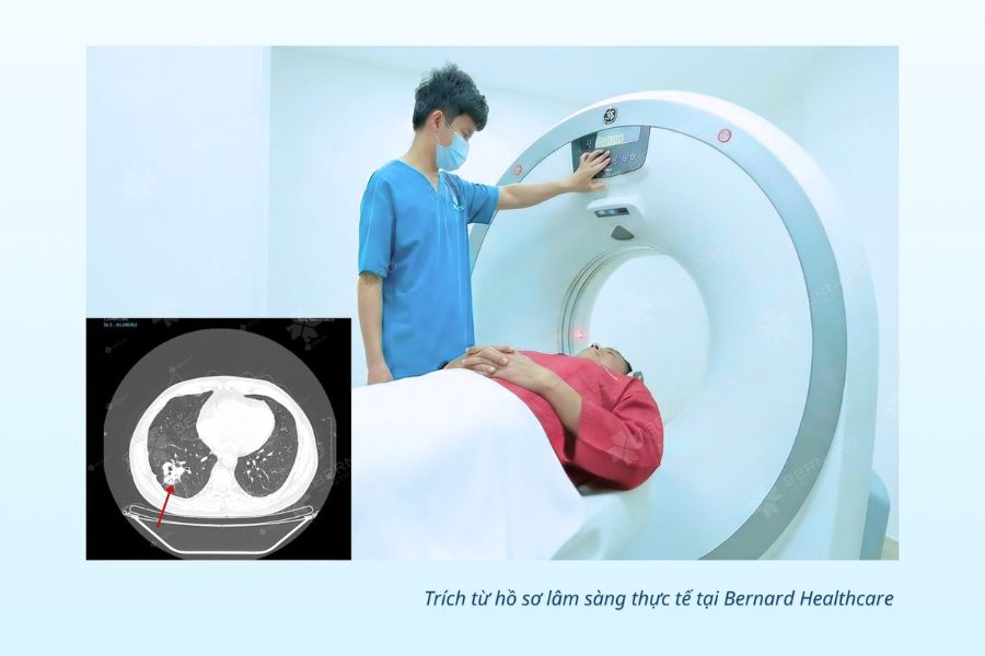 Bảng giá chụp CT tại Bernard Healthcare được công khai minh bạch giúp người bệnh dễ dàng chủ động tài chính