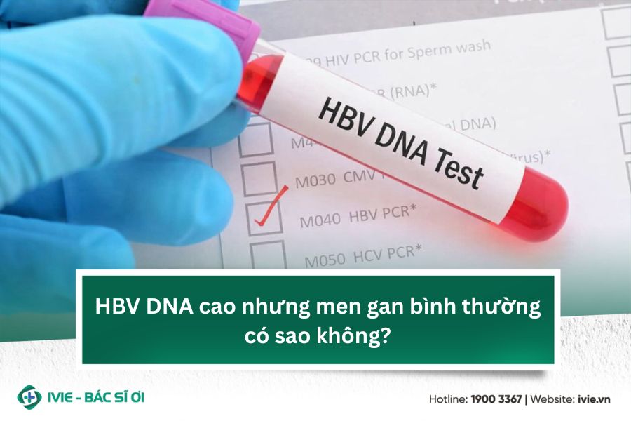 HBV DNA cao nhưng men gan bình thường có sao không?
