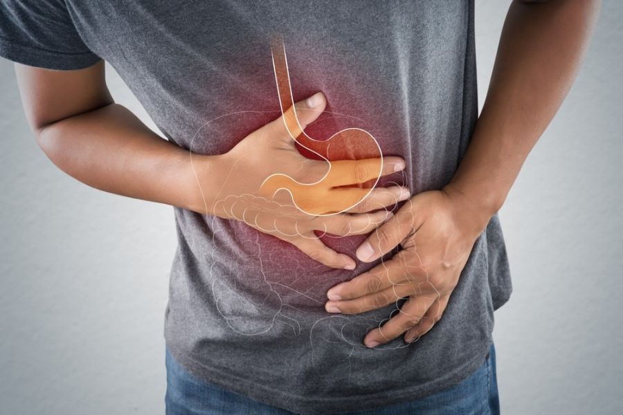 Hội chứng ruột kích thích (IBS) gây đau bụng và thay đổi thói quen đại tiện tái diễn dù không có tổn thương thực thể