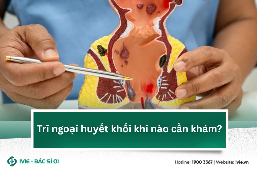 Trĩ ngoại huyết khối khi nào cần khám?