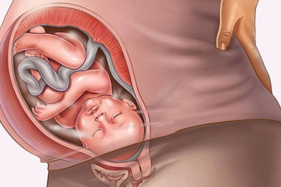 Viêm âm đạo không được điều trị đúng cách có thể tác động trực tiếp đến sự phát triển của thai nhi