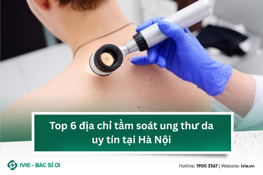 Top 6 địa chỉ tầm soát ung thư da uy tín tại Hà Nội