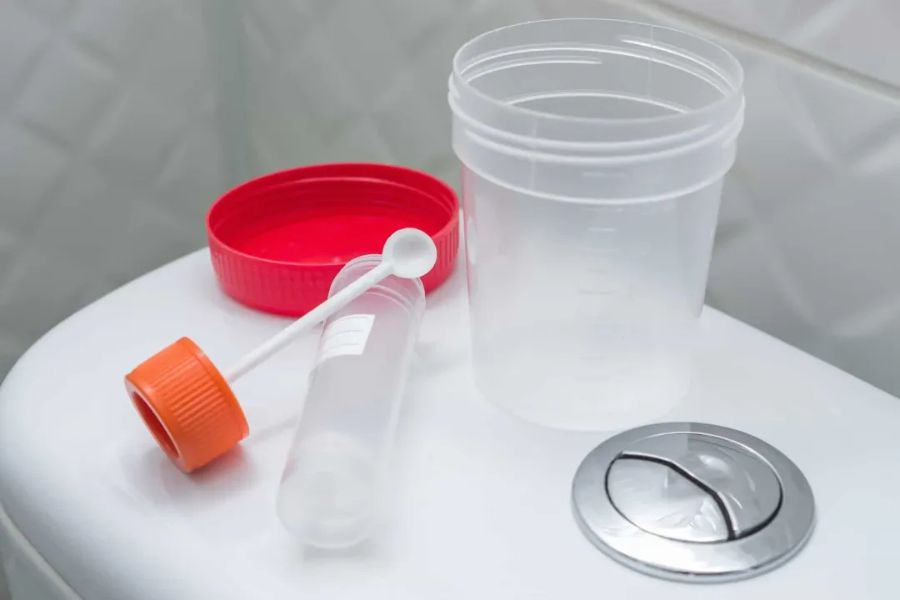 Lấy mẫu đúng hướng dẫn và thông báo tình trạng sức khỏe, thuốc đang dùng giúp đảm bảo độ chính xác của xét nghiệm FIT