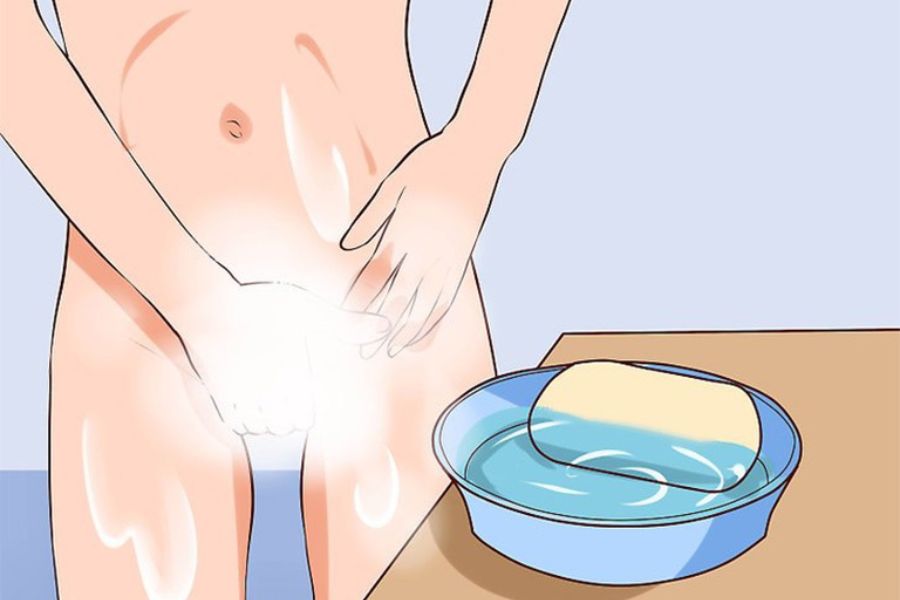 Khi ngứa vùng kín, nên vệ sinh nhẹ nhàng, tránh gãi và không tự ý dùng thuốc