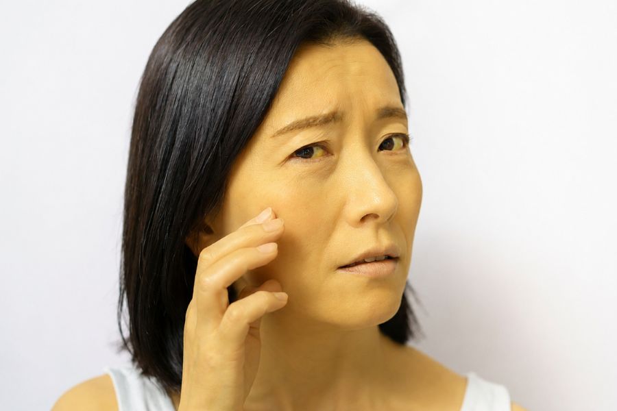 Phân loại nguyên nhân giúp xác định chính xác vàng da do gan hay tắc mật hoặc bệnh lý về máu