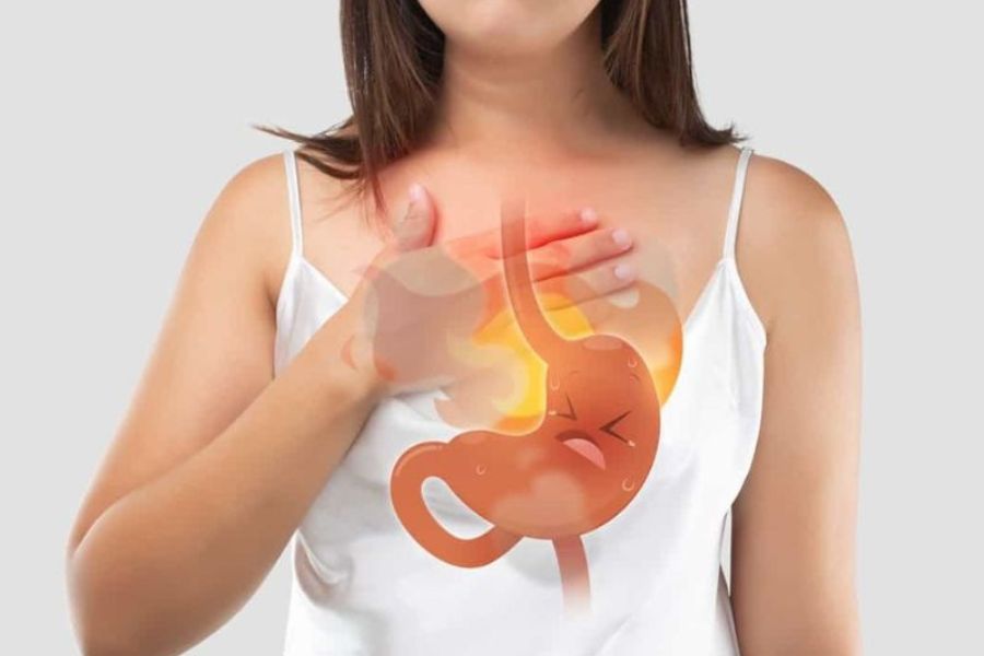 Tình trạng trào ngược axit dạ dày lên thực quản là nguyên nhân chính gây ra cảm giác ợ chua và nóng rát ngực