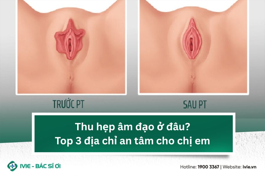 Thu hẹp âm đạo ở đâu? Top 3 địa chỉ an tâm cho chị em