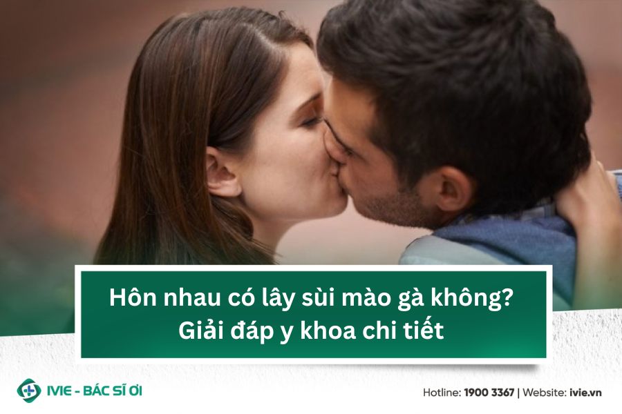 Hôn nhau có lây sùi mào gà không? Giải đáp y khoa chi tiết