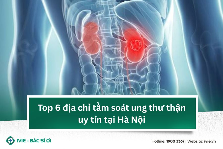 Top 6 địa chỉ tầm soát ung thư thận uy tín tại Hà Nội