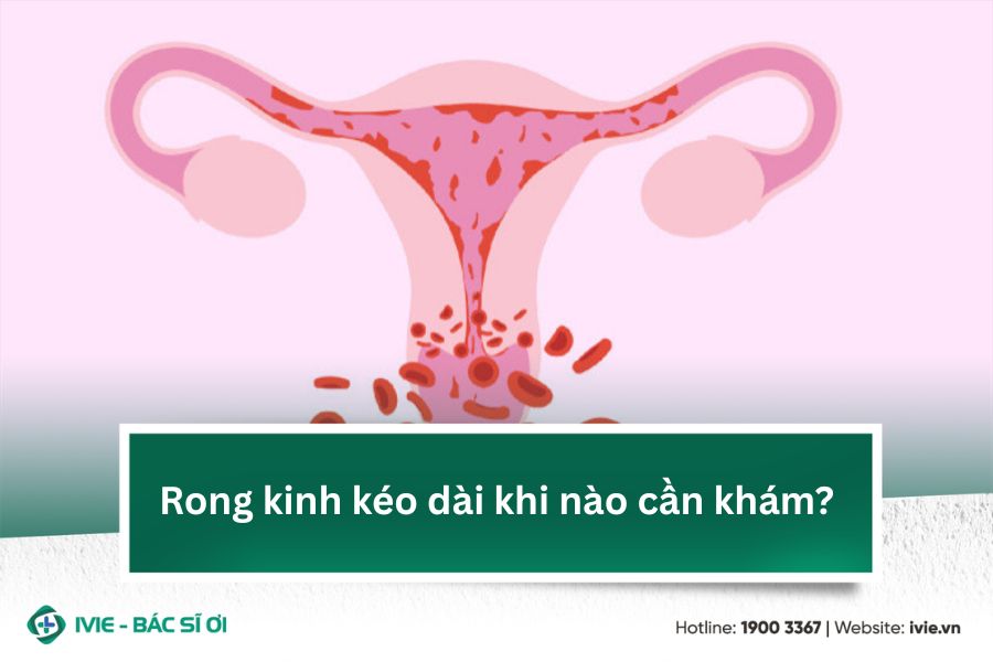 Rong kinh kéo dài khi nào cần khám?