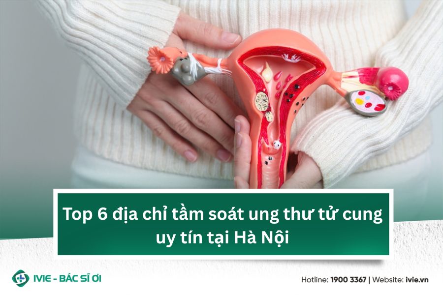 Top 6 địa chỉ tầm soát ung thư tử cung uy tín tại Hà Nội