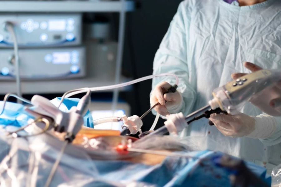 Phẫu thuật cắt túi mật nội soi chỉ áp dụng khi polyp có kích thước lớn hoặc có nguy cơ ác tính cao