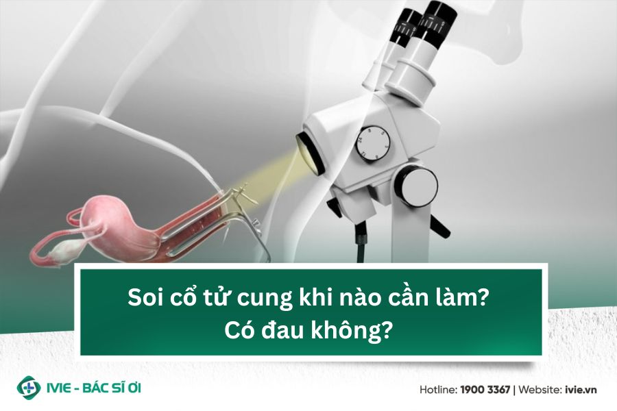 Soi cổ tử cung khi nào cần làm? Có đau không?