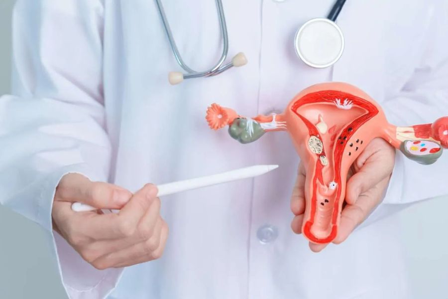 PCOS có liên quan đến đề kháng insulin, tăng hormone androgen và yếu tố di truyền