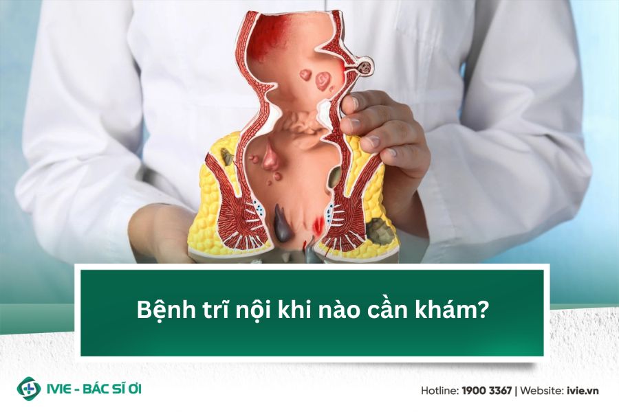 Bệnh trĩ nội khi nào cần khám?