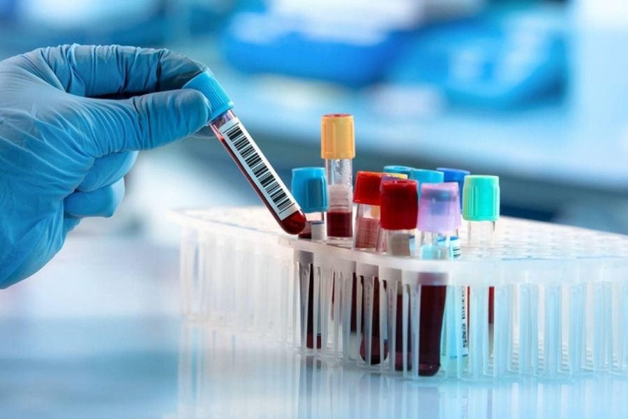 HBeAg âm tính không có nghĩa là đã khỏi viêm gan B, vì virus vẫn có thể tiếp tục nhân lên và gây tổn thương gan