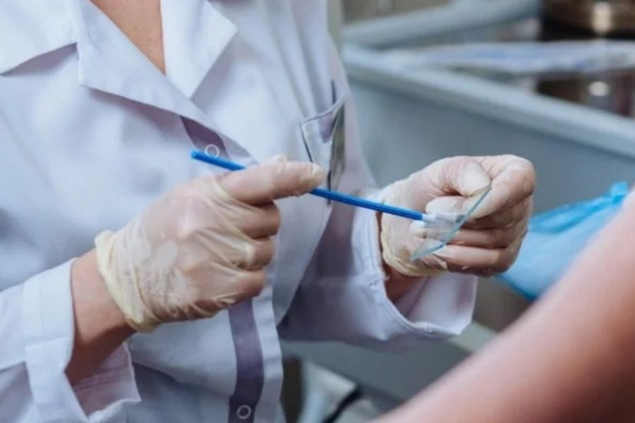 Xét nghiệm Pap smear giúp phát hiện sớm các biến đổi tế bào tại cổ tử cung