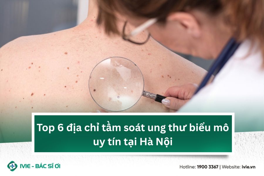 Top 6 địa chỉ tầm soát ung thư biểu mô uy tín tại Hà Nội