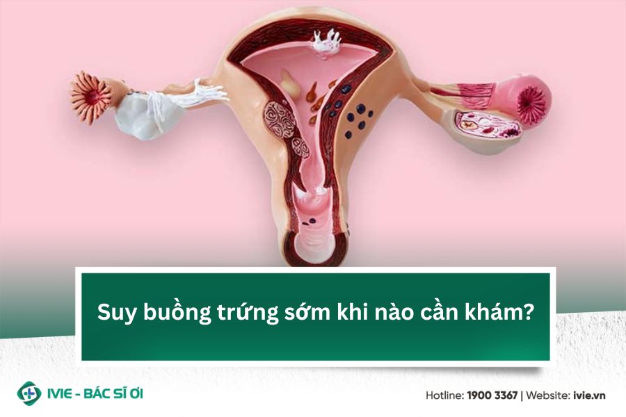 Suy buồng trứng sớm khi nào cần khám?