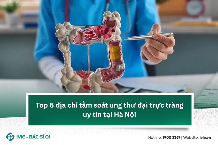 Top 6 địa chỉ tầm soát ung thư đại trực tràng uy tín tại Hà ...