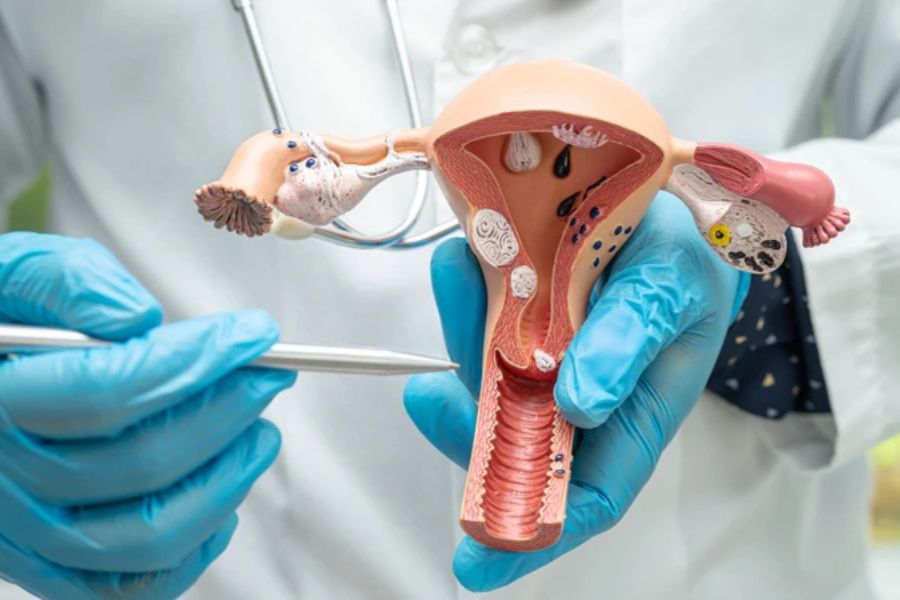 Độ dày niêm mạc tử cung thay đổi theo chu kỳ kinh nguyệt và giai đoạn sinh lý của phụ nữ
