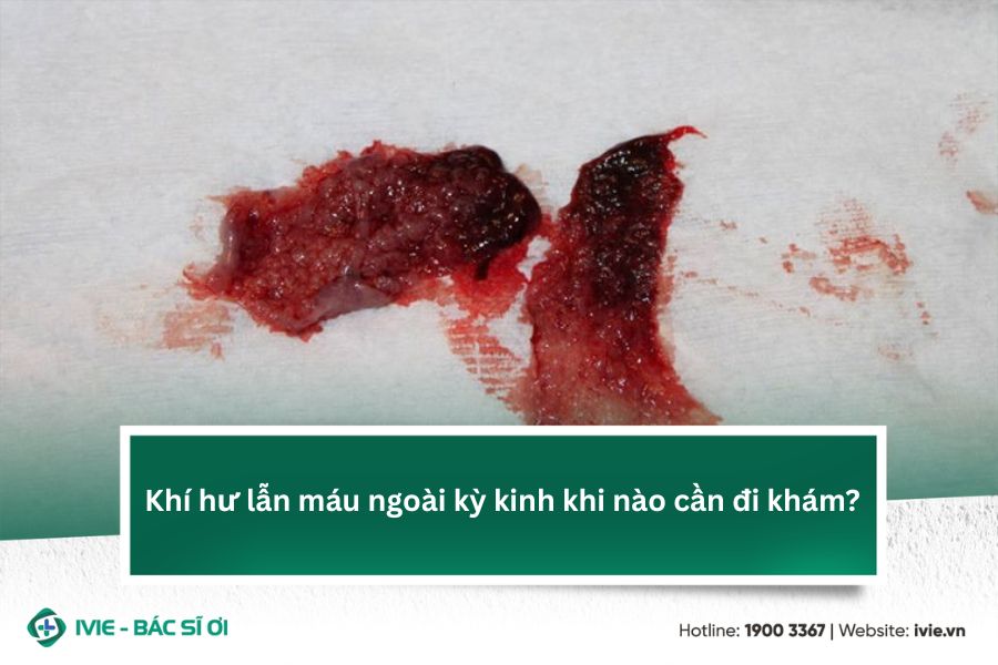 Khí hư lẫn máu ngoài kỳ kinh khi nào cần đi khám?