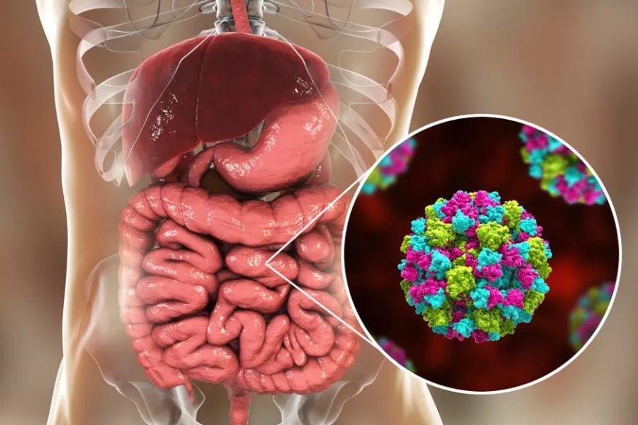 Tiêu chảy kéo dài có thể do nhiễm khuẩn, không dung nạp thực phẩm, viêm đại tràng hoặc hội chứng ruột kích thích