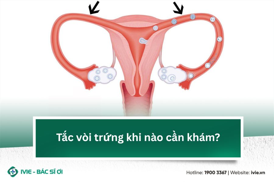 Tắc vòi trứng khi nào cần khám?