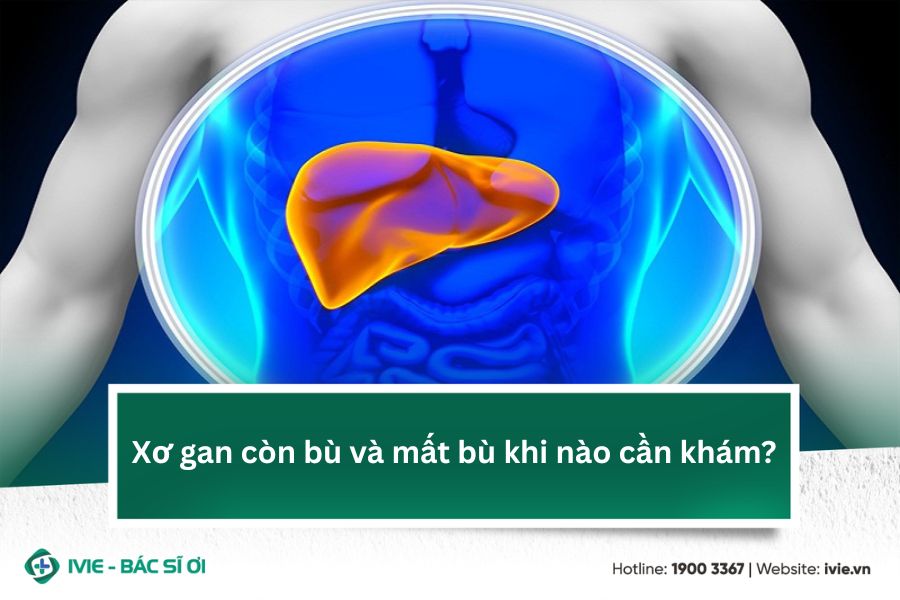 Xơ gan còn bù và mất bù khi nào cần khám?