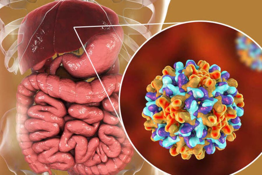 HBV DNA cao cho thấy lượng virus trong máu cao; men gan bình thường chưa đủ để khẳng định gan không bị tổn thương