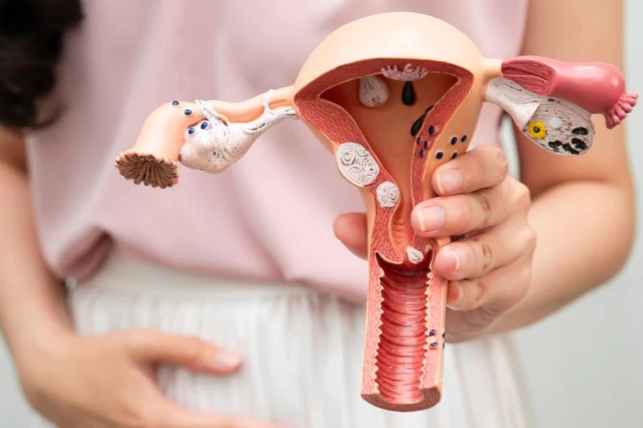 Viêm cổ tử cung không được điều trị có thể ảnh hưởng sức khỏe sinh sản