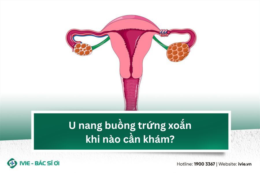 U nang buồng trứng xoắn khi nào cần khám?
