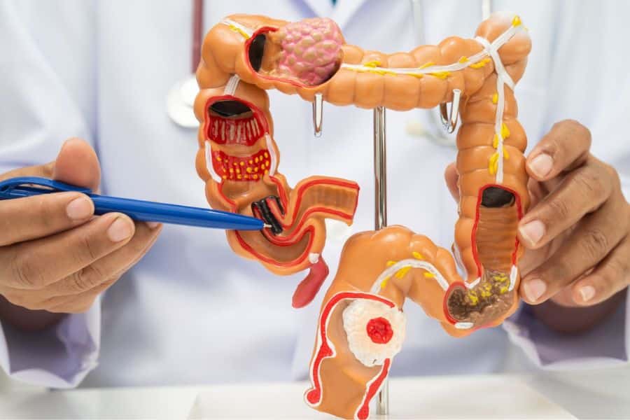 Tầm soát ung thư hệ tiêu hóa định kỳ giúp phát hiện sớm các tổn thương tiền ung thư khi chưa xuất hiện triệu chứng
